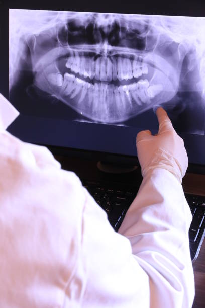 Best Emergency Dentist for Special Needs Patients in Fair Oaks, CA